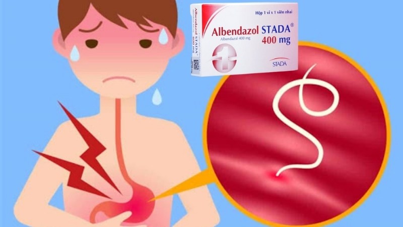 albendazole 400mg là thuốc gì - Image 5