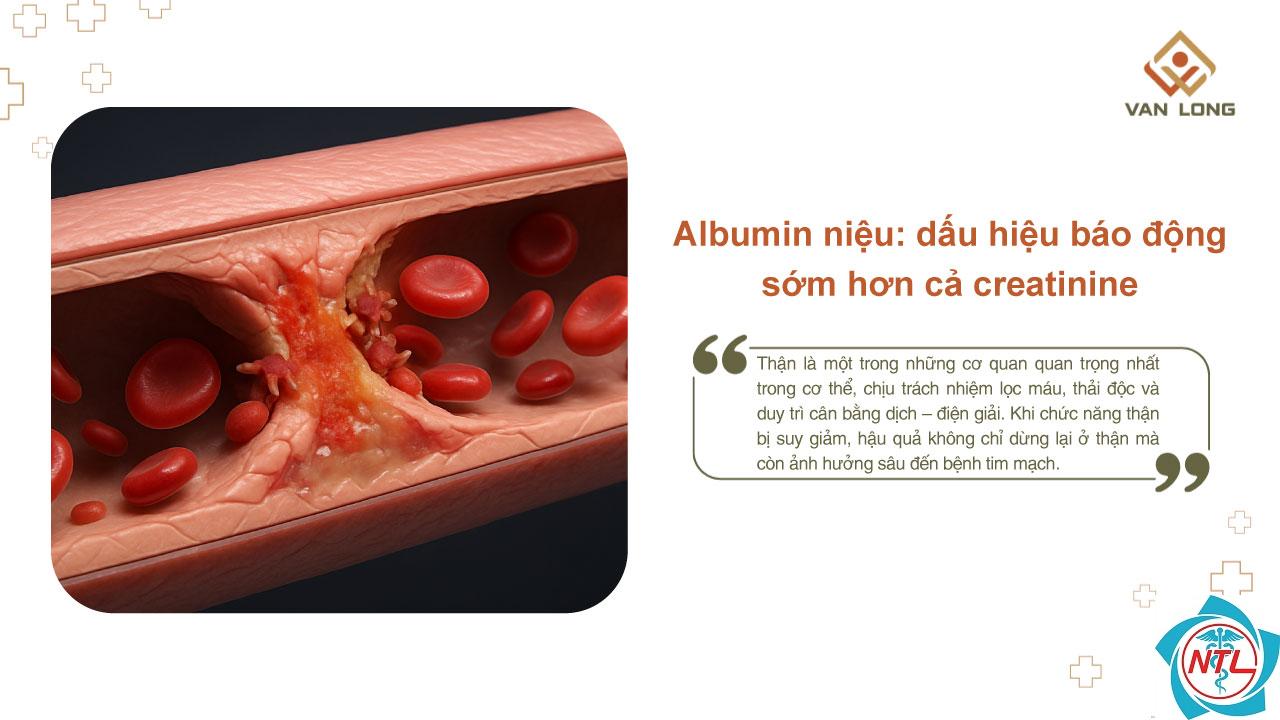 albumin niệu - Image 3