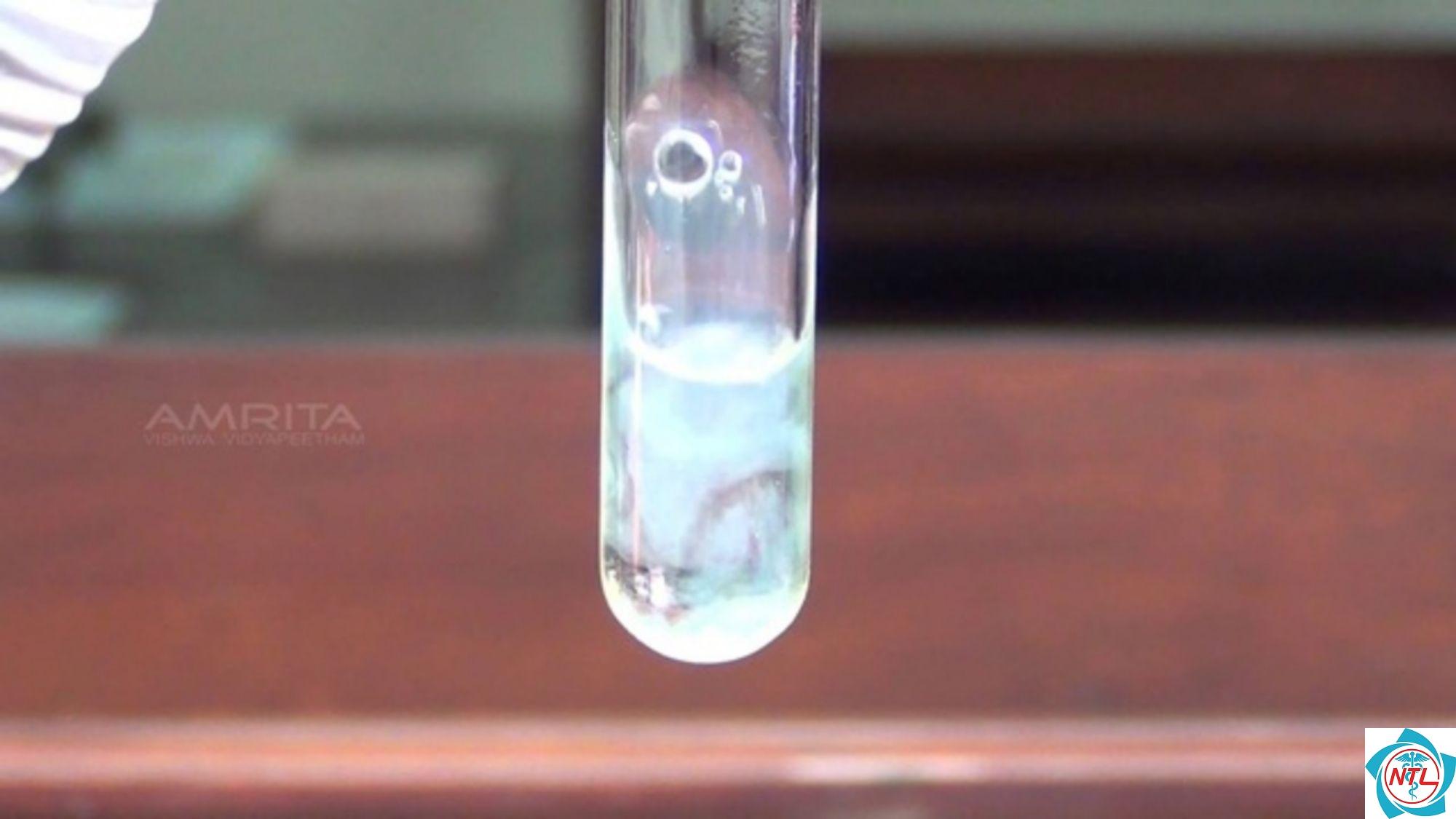 albumin niệu - Image 5