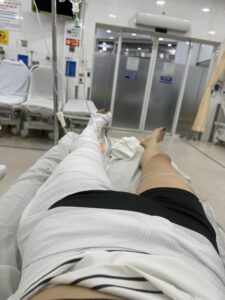 ảnh bị gãy chân