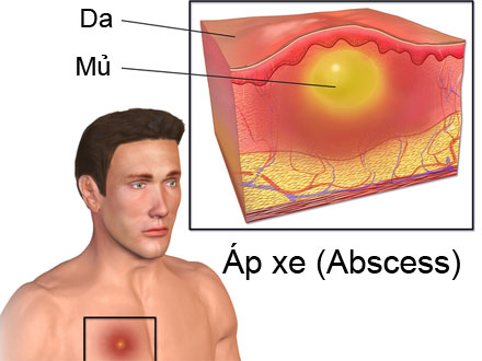 áp xe da - Image 4