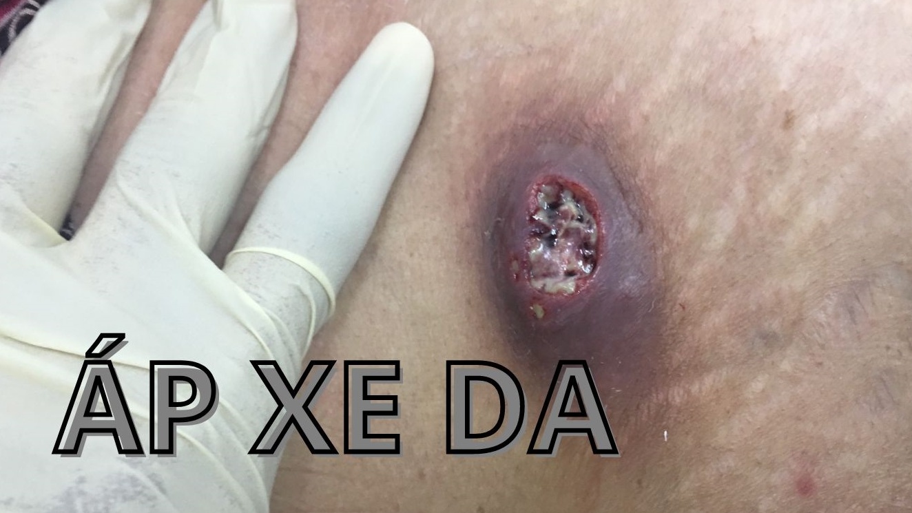 áp xe da - Image 1