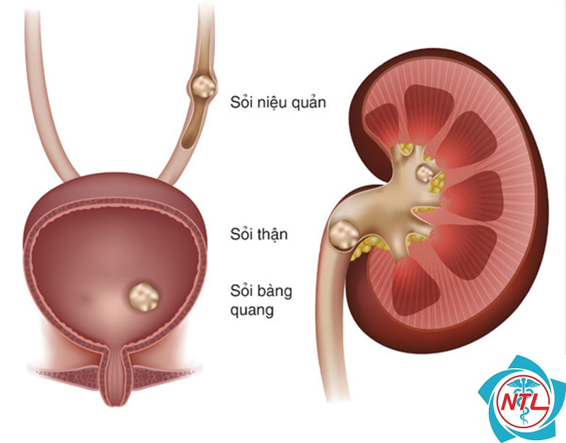 áp xe thận