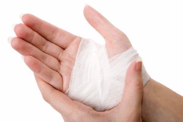 băng chèn được sử dụng cho vết thương nào - Image 2