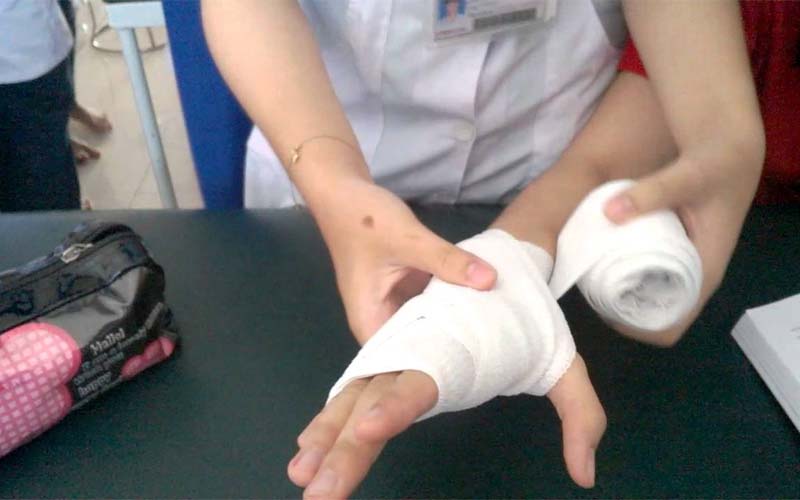 băng chèn được sử dụng cho vết thương nào - Image 5