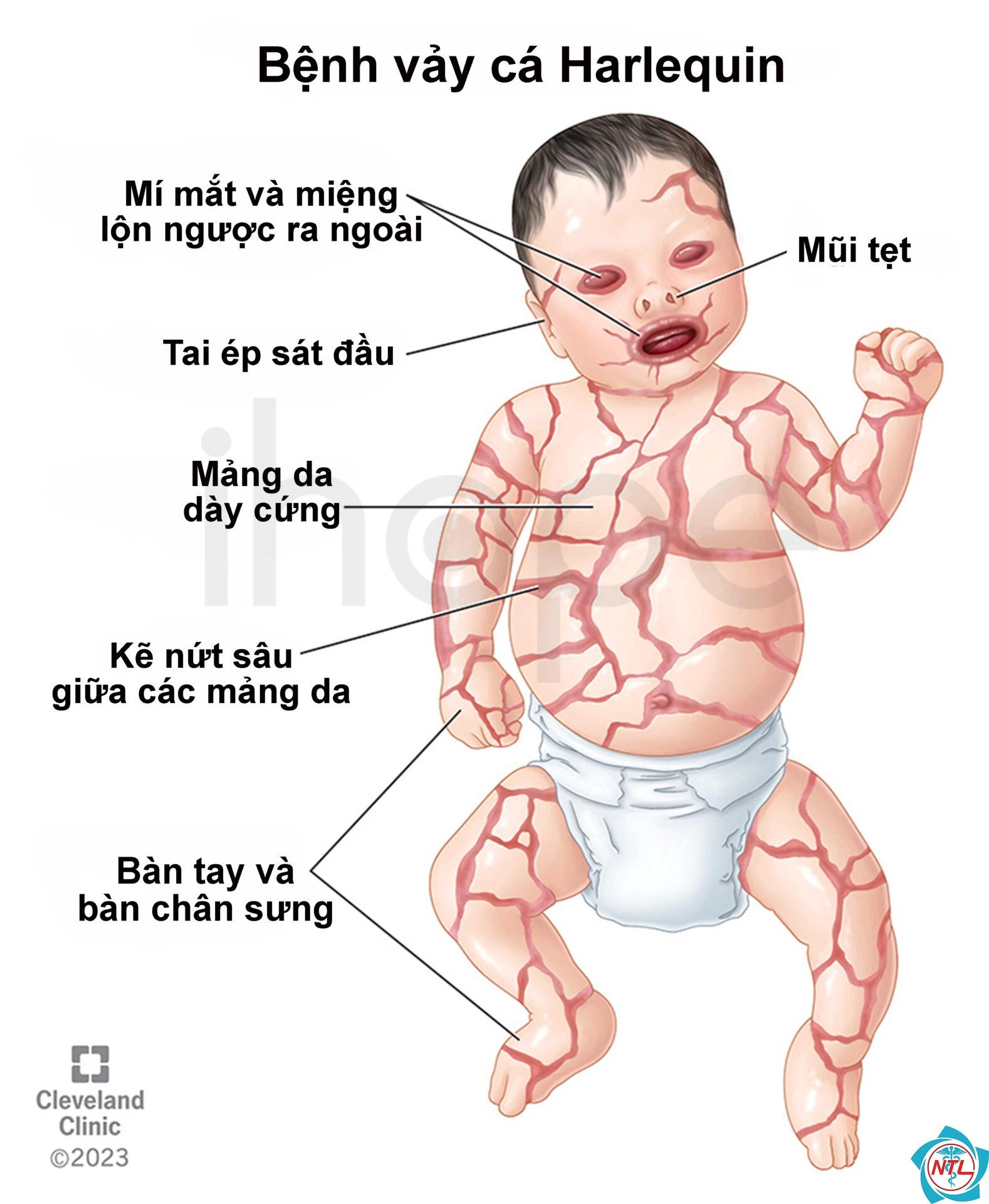 bệnh da bẩm sinh - Image 3