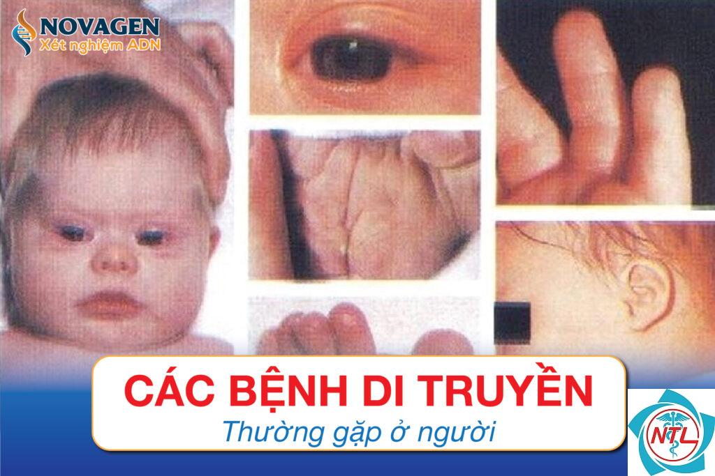 bệnh da di truyền ở trẻ em