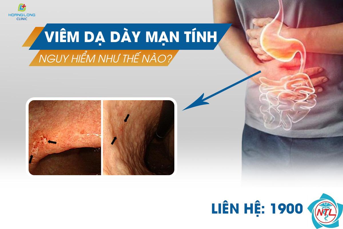 bệnh da loét mạn tính - Image 2