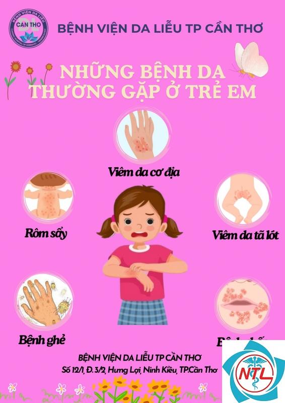 bệnh da thường gặp ở trẻ em - Image 3