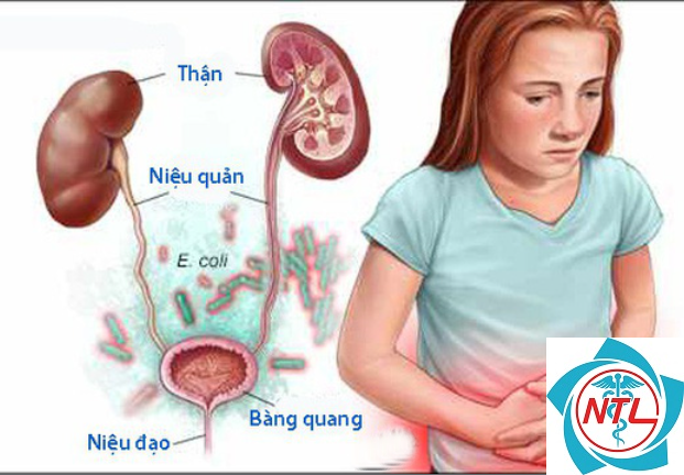 bệnh hệ tiết niệu - Image 3