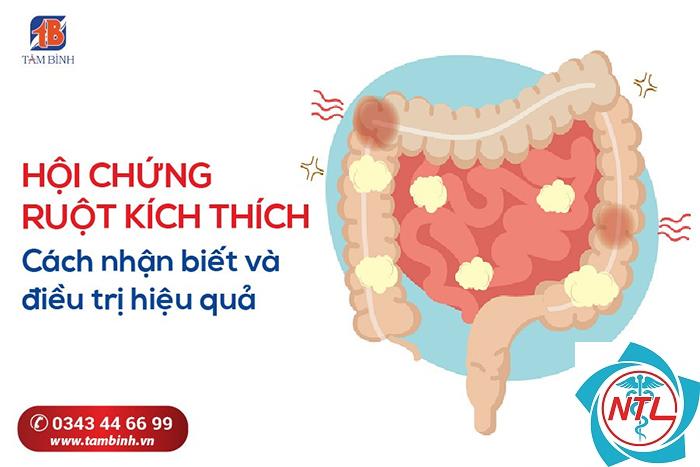 bệnh ibs là gì - Image 3
