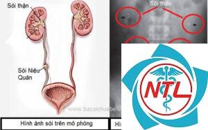 bệnh lý niệu quản