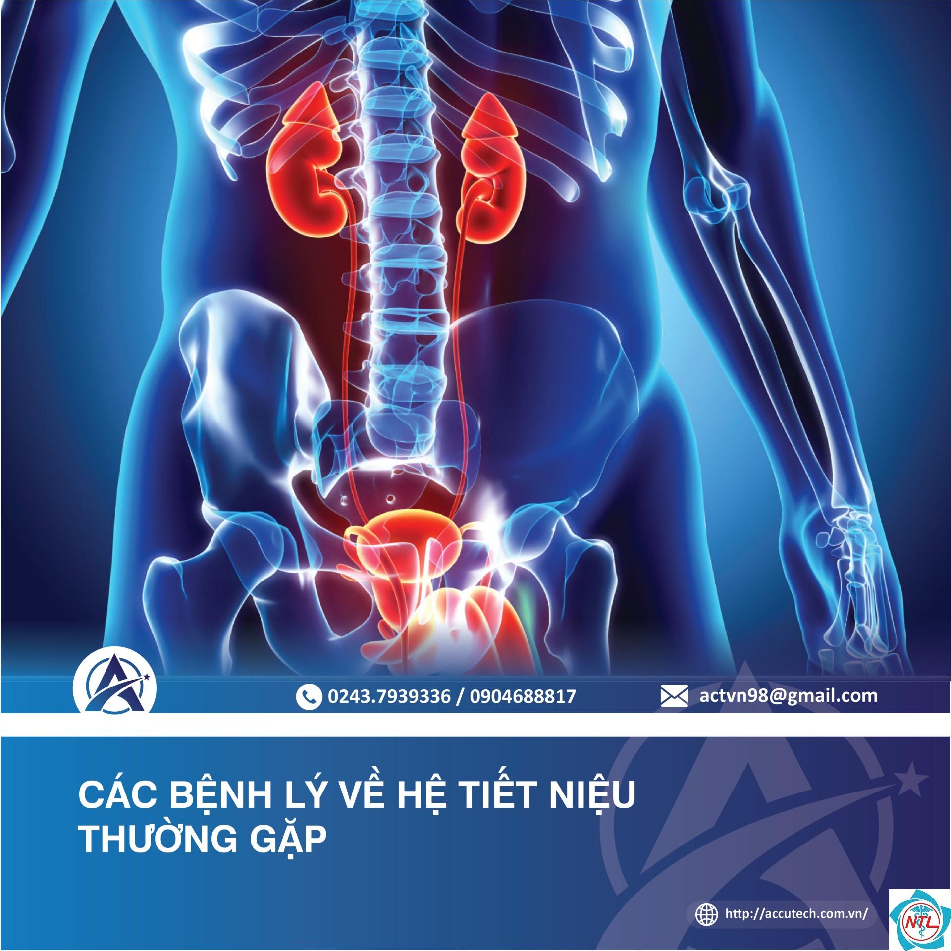 bệnh lý tiết niệu - Image 4