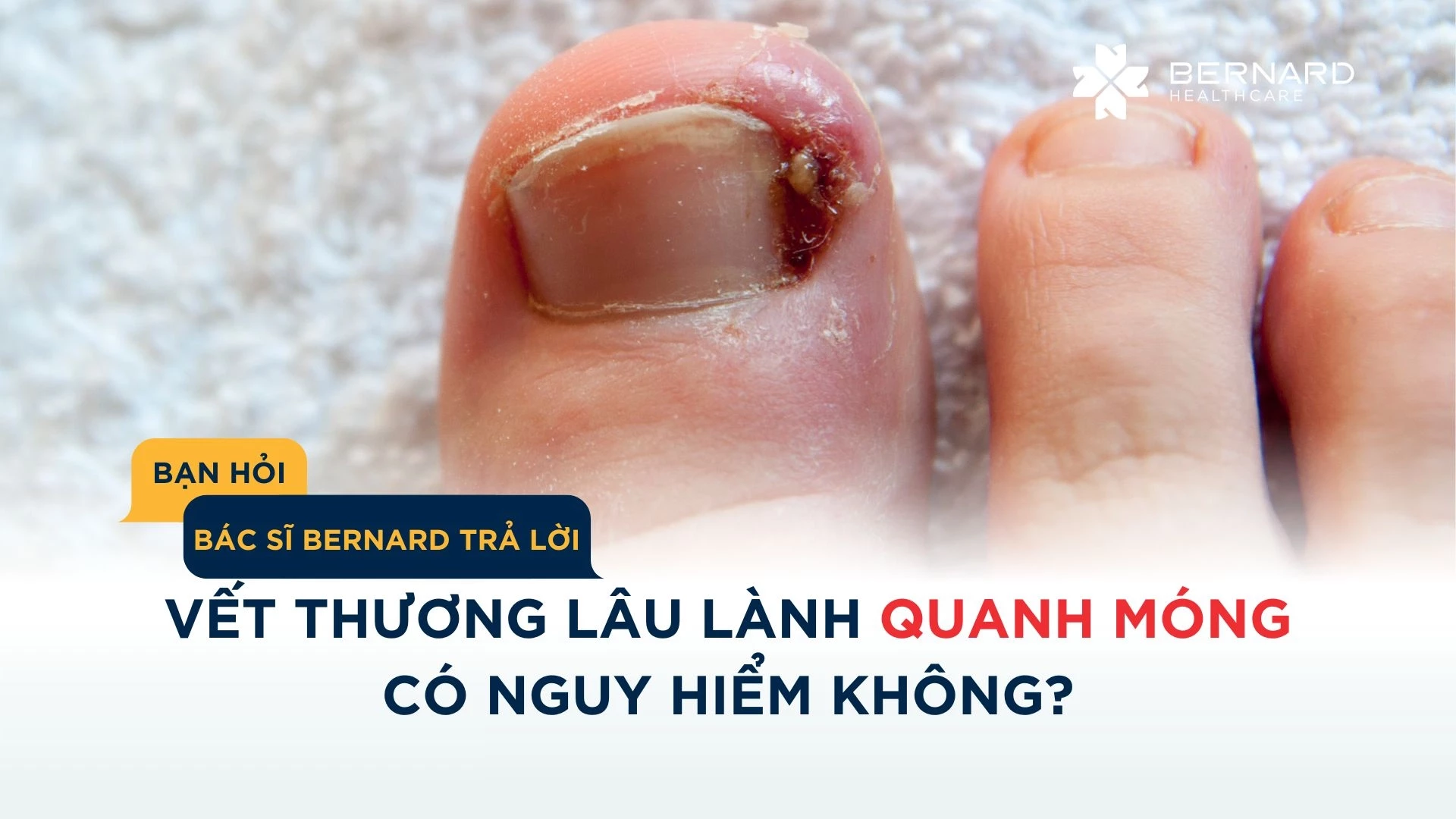 bệnh móng do chấn thương - Image 5