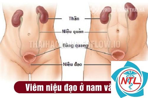 bệnh niệu đạo - Image 1