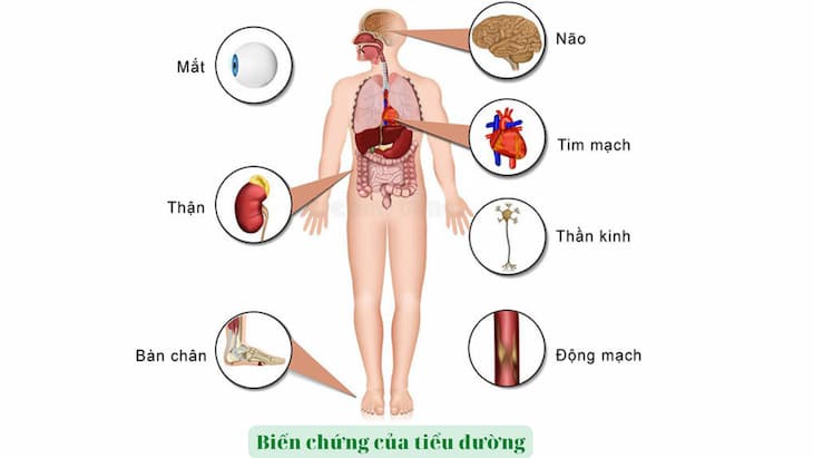 bệnh nội tiết - Image 4