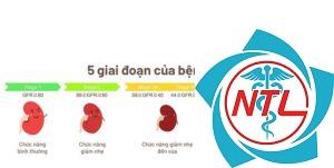 bệnh thận giai đoạn 2