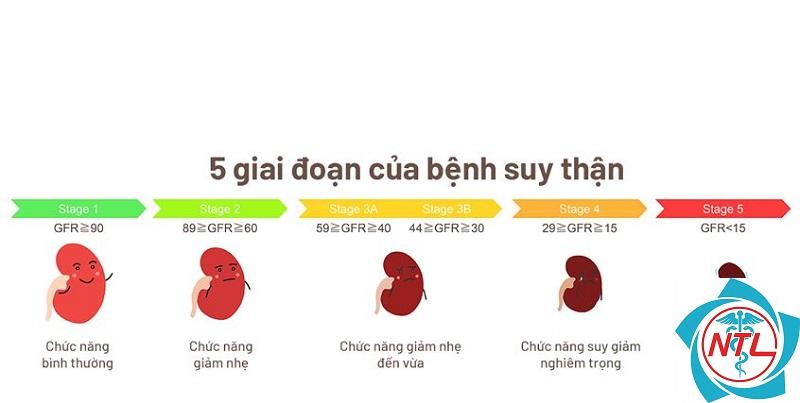 bệnh thận giai đoạn 2