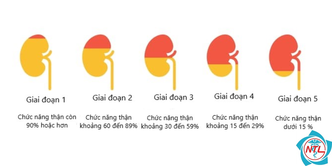 bệnh thận giai đoạn 4 - Image 5