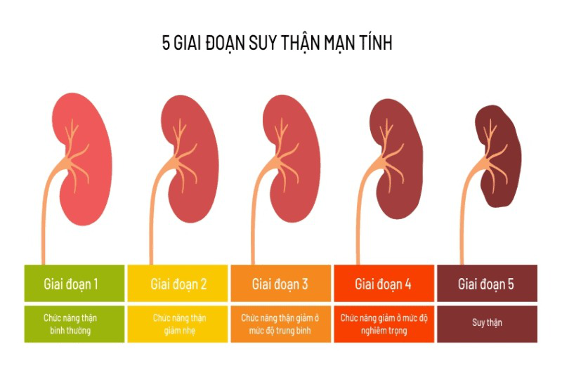 bệnh thận giai đoạn 5 - Image 5