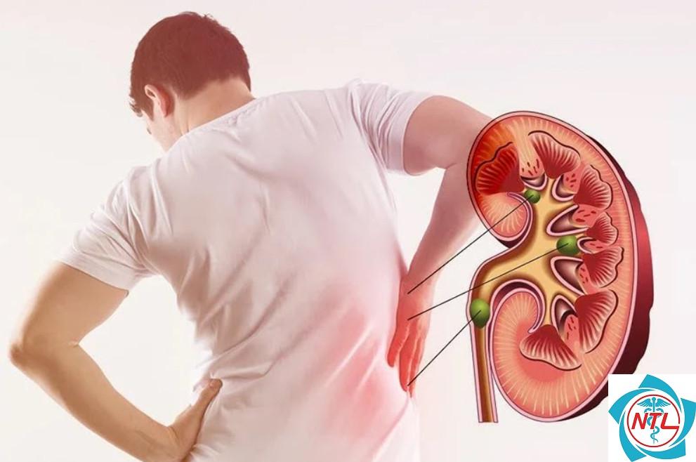 bệnh thận giai đoạn cuối