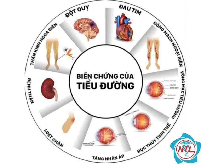 bệnh thận mạn do đái tháo đường - Image 4