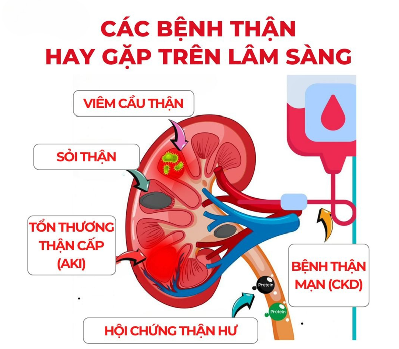 bệnh thận thường gặp - Image 4