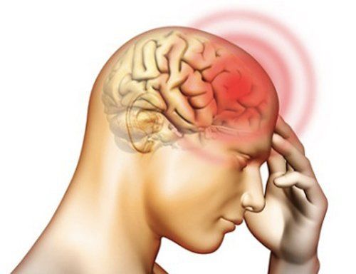 bị dập não có hồi phục được không - Image 2