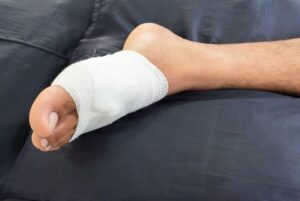 bị đinh đâm vào chân