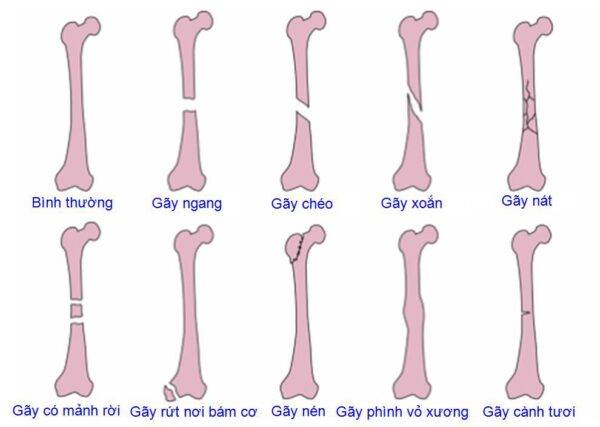 bị gay - Image 4