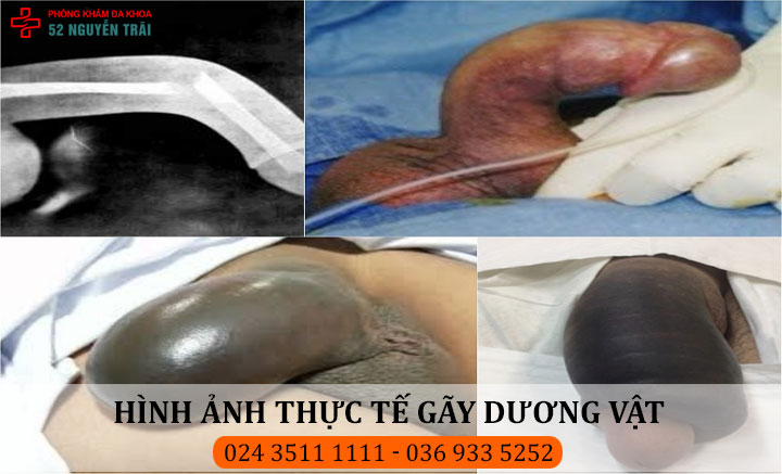 bị gay - Image 5