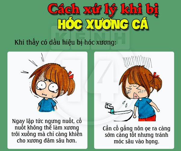 bị hóc xương cá