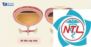bí tiểu mạn tính