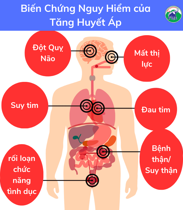 biến chứng tăng huyết áp - Image 1