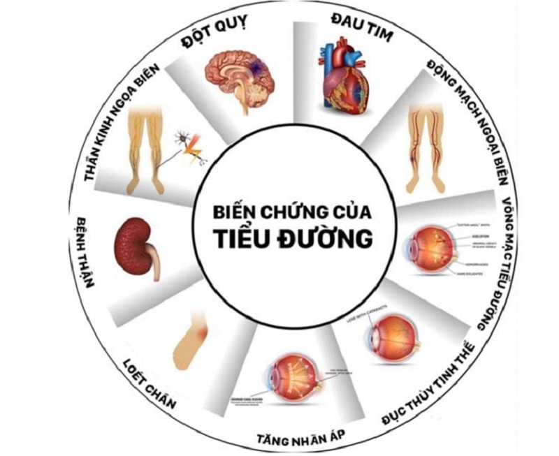 biến chứng thận do tiểu đường - Image 2