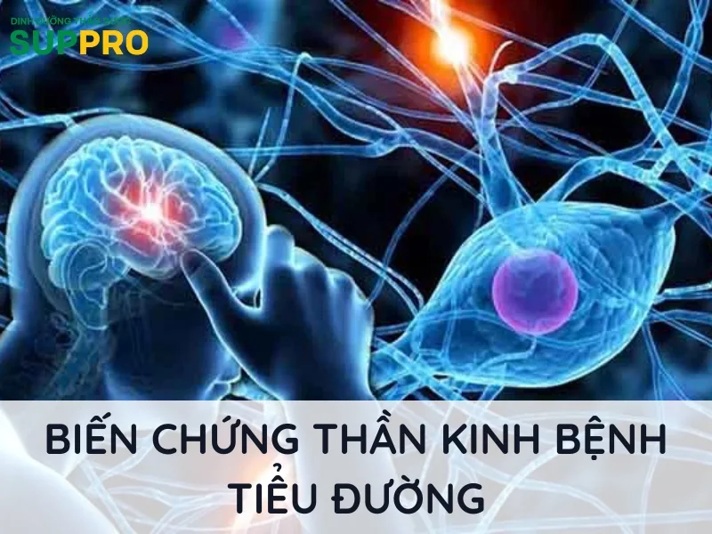 biến chứng thần kinh do tiểu đường - Image 3