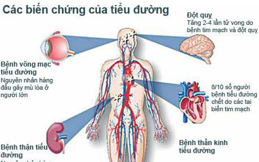 biến chứng tim mạch của tiểu đường - Image 3