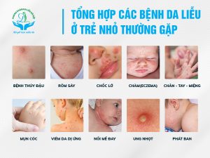 các bệnh về da của trẻ sơ sinh
