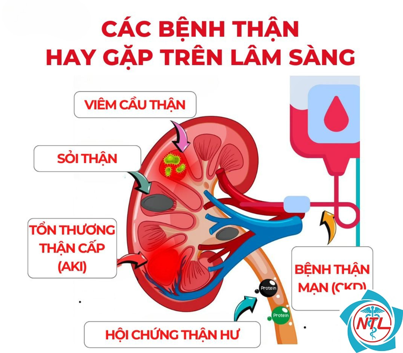 các bệnh về thận - Image 5