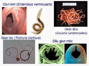 các loại giun