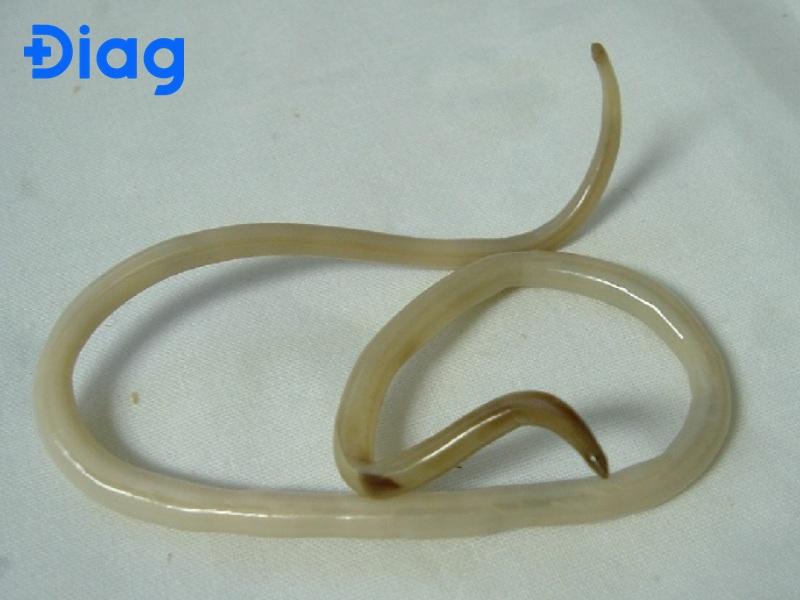 các loại giun - Image 5