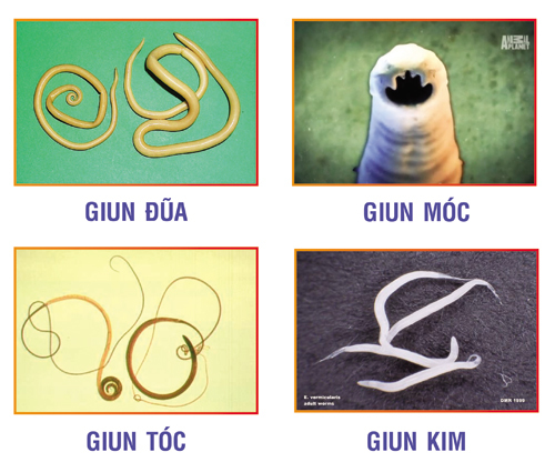 các loại giun ở trẻ em - Image 2