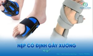 các loại nẹp cố định gãy xương
