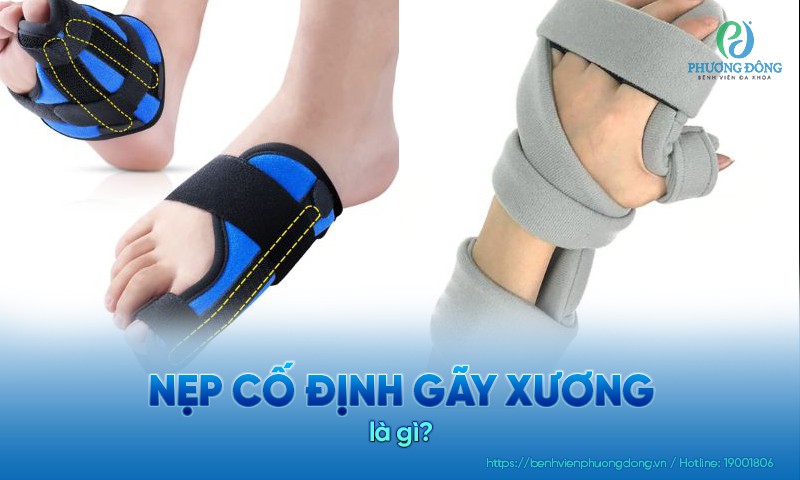 các loại nẹp cố định gãy xương