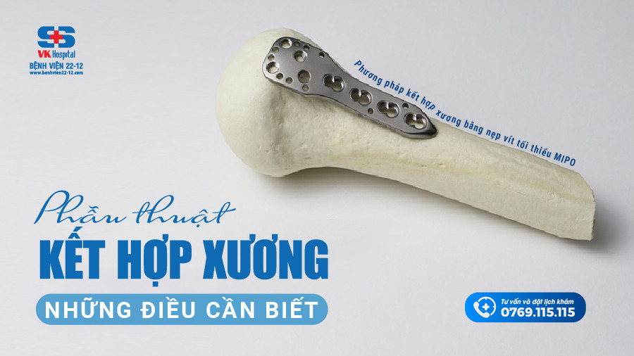 các loại nẹp vít xương - Image 5