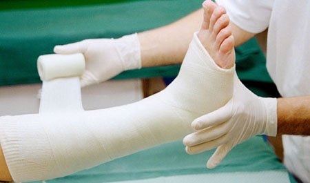 cách chăm sóc chân sau khi tháo bột - Image 4