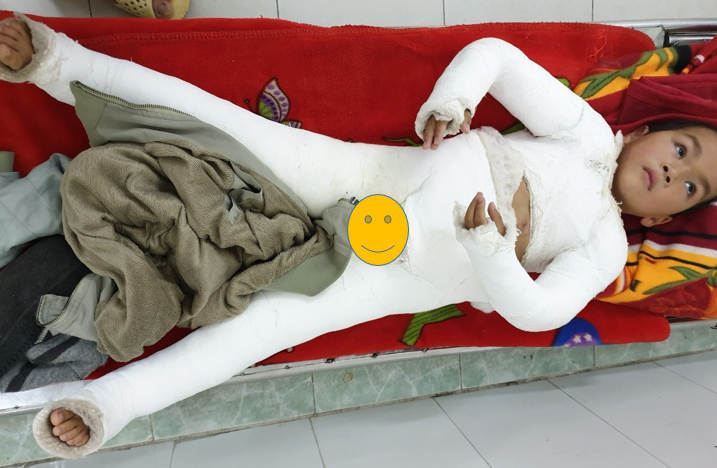 cách chăm sóc chân sau khi tháo bột - Image 5