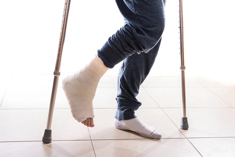 cách chăm sóc người bị gãy chân - Image 3