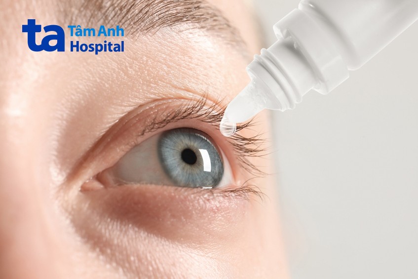 cách chữa mắt bị đổ ghèn - Image 4