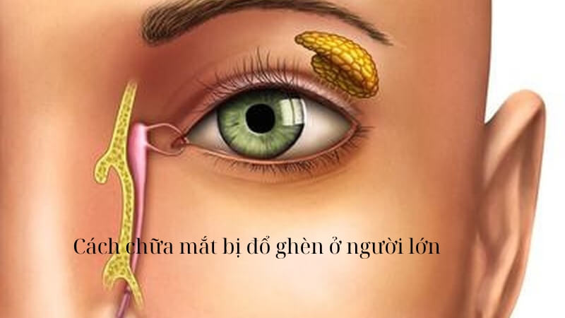 cách chữa mắt bị đổ ghèn ở người lớn - Image 5